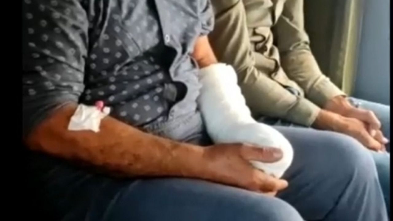 Polis helikopteri parmağı kesilen vatandaş için havalandı