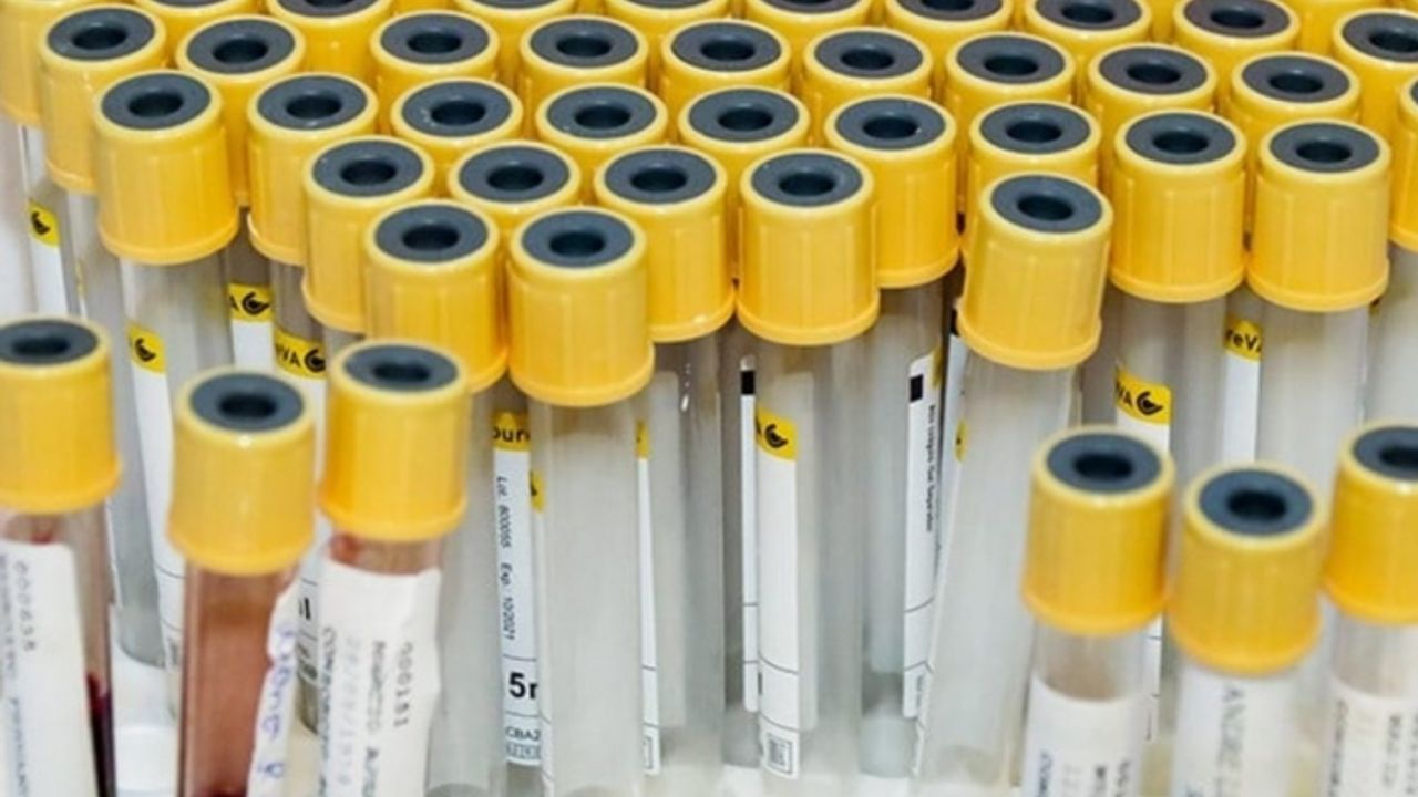 Van YYÜ, mikrobiyoloji test kiti satın alacak