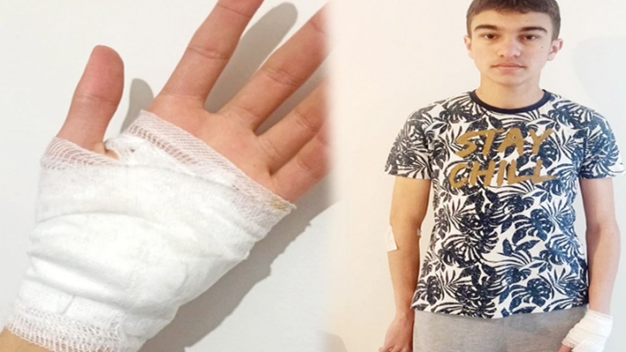 Van'da sokak köpekleri bir çocuğu yaraladı