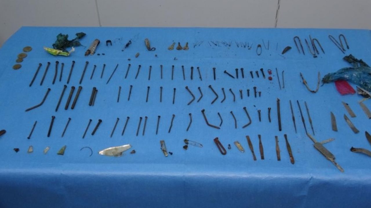 Vanlı kadının midesinden 158 parça metal çıktı