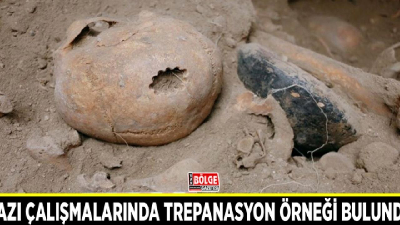 Kazı çalışmalarında trepanasyon örneği bulundu
