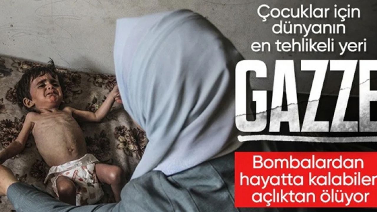 Gazze'de çocuklar yetersiz beslenme nedeniyle ölümle pençeleşiyor