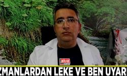 Uzmanlardan leke ve ben uyarısı