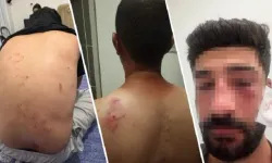 Mersin’de ırkçı saldırı iddiası: Kürtçe konuştukları için!