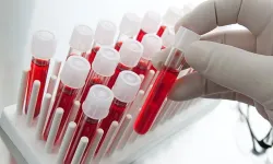 Kan grubu nitel mi nicel mi?