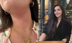 Görevini Yapan Vanlı Kadın Avukata Otelde Saldırı