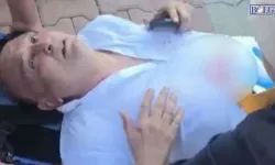 Milletvekiline Bıçaklı Saldırı: Hastaneye Kaldırıldı