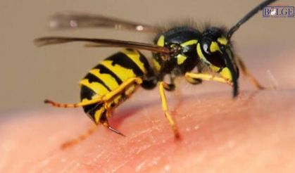 Arı Sokması Sandığınız Kadar Masum Olmayabilir! Uzmandan Hayati Uyarılar