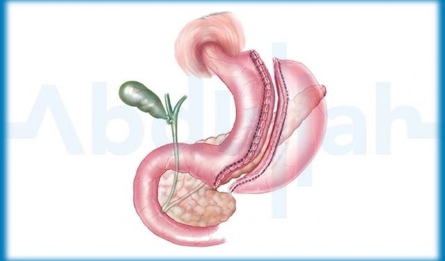 Sağlığınızın Düşmanı: Obezite ve Bilinmeyenler