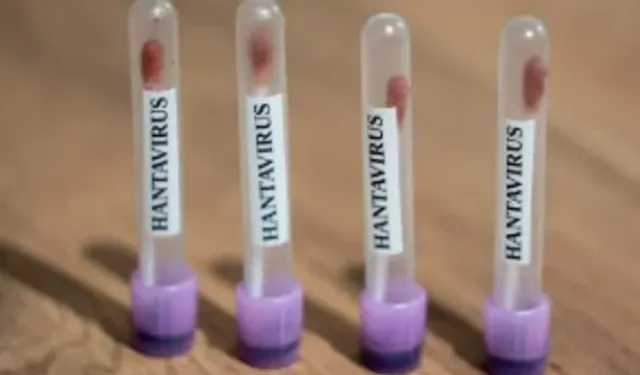 Hantavirüs nedir? Hantavirüs nasıl bulaşır, Hantavirüs tedavisi var mıdır?