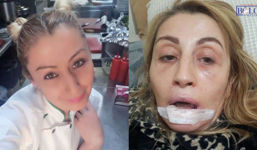 Estetik Hayali Kabusla Bitti! Dudakları Çürüdü