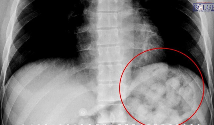 Van Otogarı’nda yakalandı: Midesinden çıkanlar şaşırttı